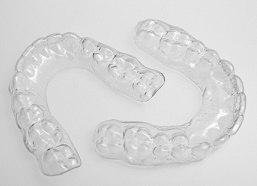 Retainers Cause Tooth Abrasion - Houston Endodontist