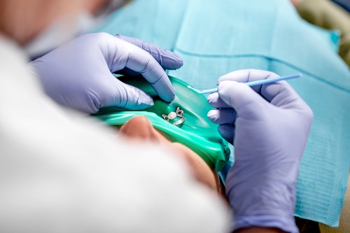 Houston endodontist surgical repositioning 