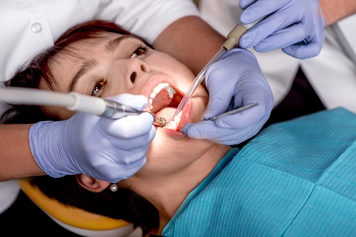 endodontist Houston