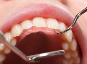Tooth Health Maintenance