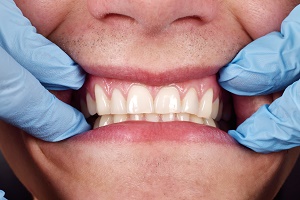 Houston endodontics